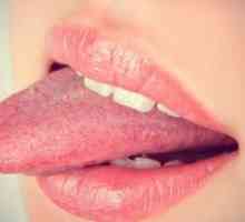 Rjave lise na jeziku pri odraslih - Vzroki