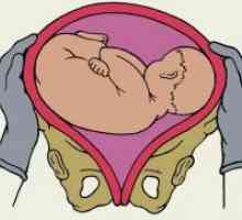 Poševno položaj zarodka