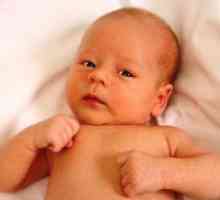Tortikolis na otroka 3 mesece - Simptomi