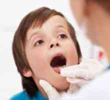 Laringitis pri otrocih - simptomi