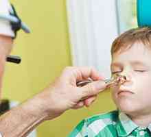 Zdravljenje nosnih polipov pri otrocih