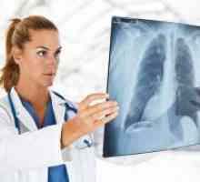 Miliarnega tuberkuloza