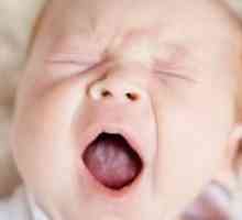 Soor v otroška usta - kot zdraviti?