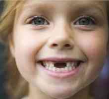 Mlečni zobje pri otrocih