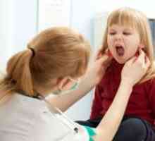 Mononukleoza pri otrocih - Zdravljenje