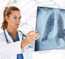 Ali je mogoče storiti v prsih rentgenske žarke med nosečnostjo?
