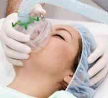 Anestezija za carskim rezom