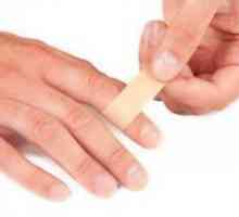 Absces na prstu - Zdravljenje