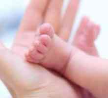Non-imunski fetalnih hidrops