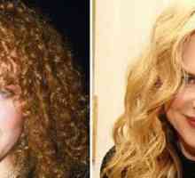 Nicole Kidman - pred in po plastičnih mas