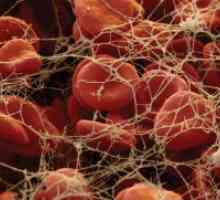 Nizka raven trombocitov v krvi - razlog
