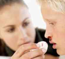 Krvavitve iz nosu pri otrocih - Vzroki