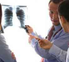 Obstruktivni bronhitis - Zdravljenje