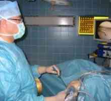 Operacija na meniskusa kolena