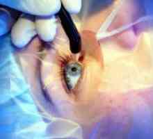 Popravni operacijo oči