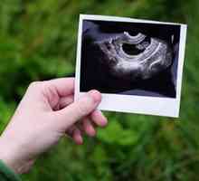 Določanje spola otroka na ultrazvoku