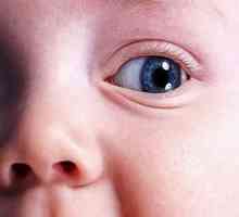 Otekanje otrokovih očeh