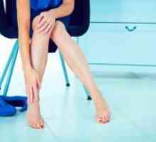 Otekle noge - vzrok za ženske