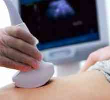 Prvi ultrazvok v nosečnosti