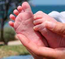 Ploska stopala pri otrocih