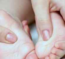Ploskovalgusnye noge pri otrocih - Zdravljenje