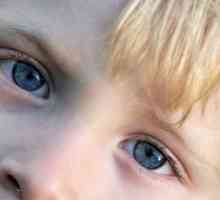 Zakaj boli oči otroka