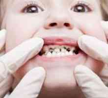 Zakaj otroci obrnejo črne otroške zobe?
