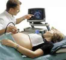 Kazalniki ultrazvok 32 tednov noseča