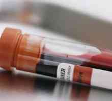 Povečana inzulina v krvi - vzroki