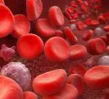 Zvišane belih krvnih celic v krvi - Vzroki