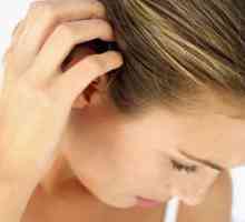 Vzroki za akne na glavi