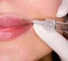 Princip delovanja in učinkovitosti Botox ustnic