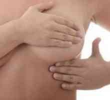Simptomi mastitisa pri ženskah