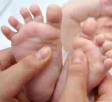 Preprečevanje ploskih nog pri otrocih