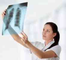 Preprečevanje tuberkuloze