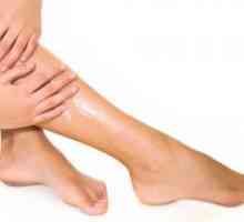 Preprečevanje krčne žile na nogah