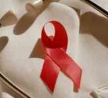 Okužba preprečevanje HIV