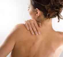 Akne na hrbtu in ramenih