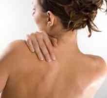 Akne na hrbtu - vzroki