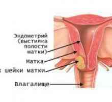 Rak materničnega vratu - znaki