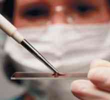 Dekodiranje testov krvi pri otrocih - tabela