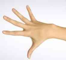 Raztezanje mišic roke - Zdravljenje
