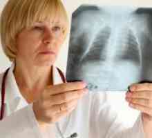 Sarkoidoza pljuč - simptomi
