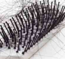 Huda izguba las pri ženskah - kaj storiti?