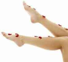 Žile Sclerotherapy noge