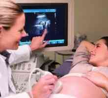 Kolikokrat lahko naredimo ultrazvok v nosečnosti?
