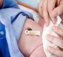 Kako se zdravilne popka za novorojenčka?