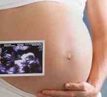 Presejanje v nosečnosti