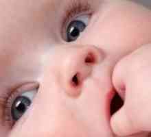Stomatitis pri dojenčkih