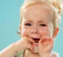 Stomatitis pri otroku - 2 leti